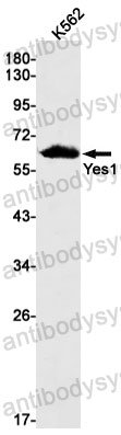 Anti-YES1 Antibody (R1L26)