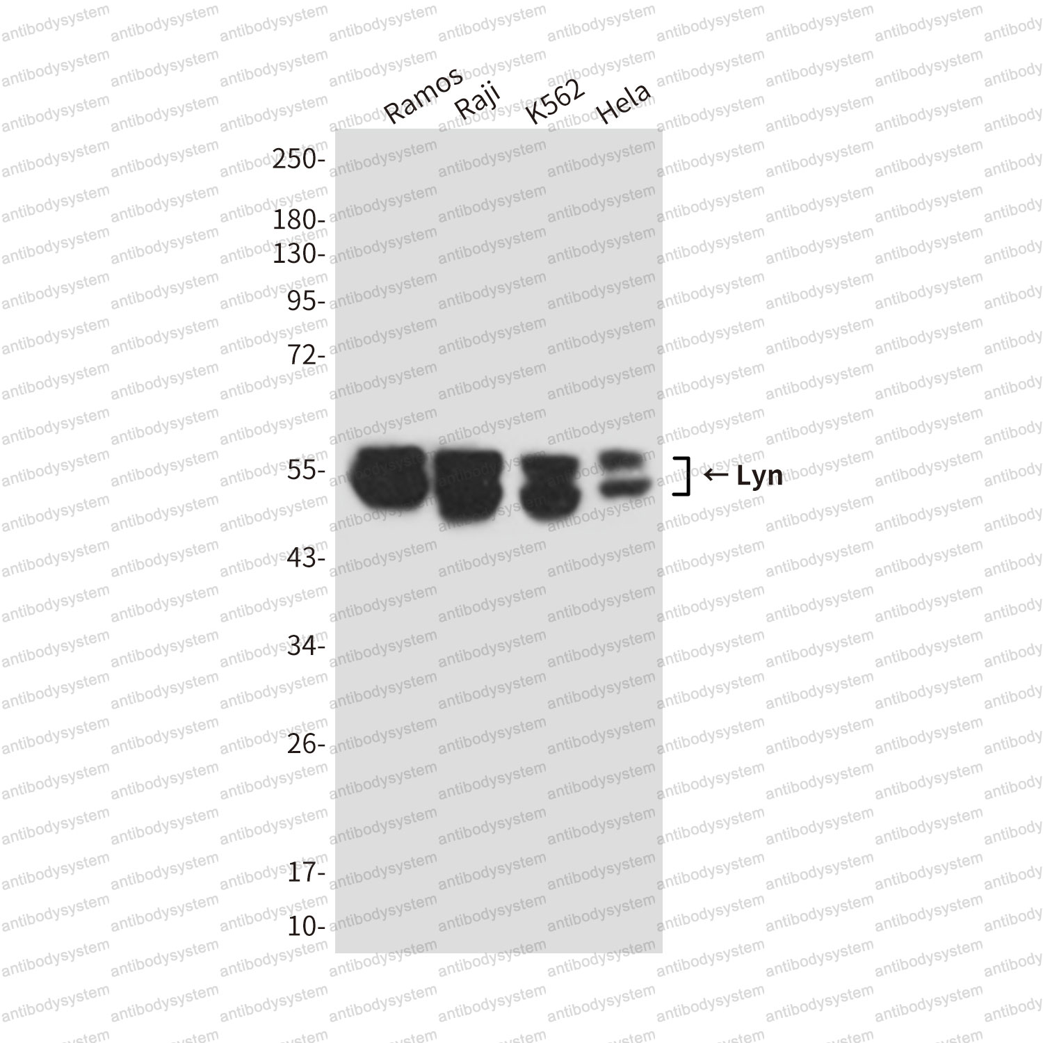 Anti-LYN Antibody (R3A40)