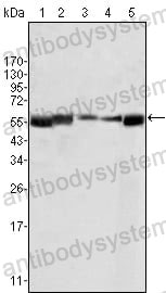 Anti-LYN Antibody (R3A39)