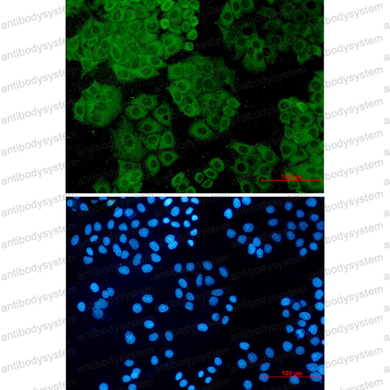 Anti-FH Antibody (R1L27)