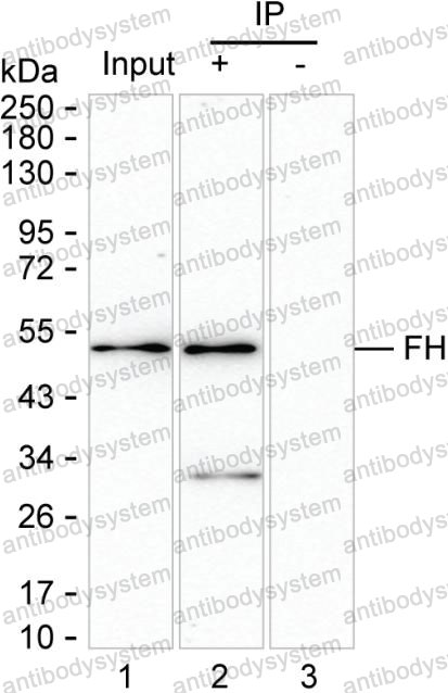 Anti-FH Antibody (R3A41)