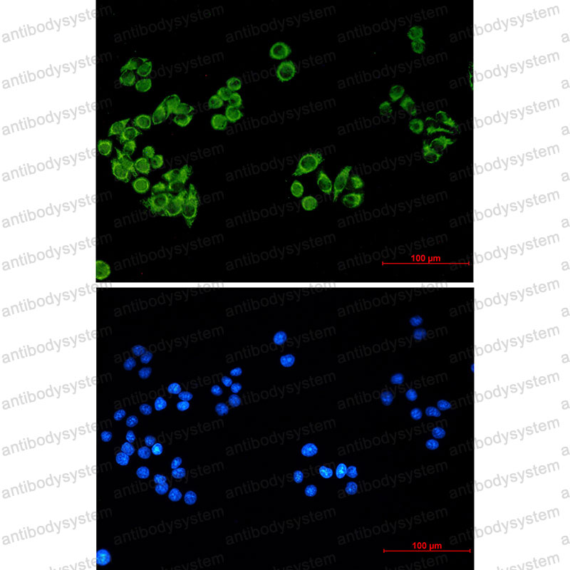 Anti-FH Antibody (R3A42)