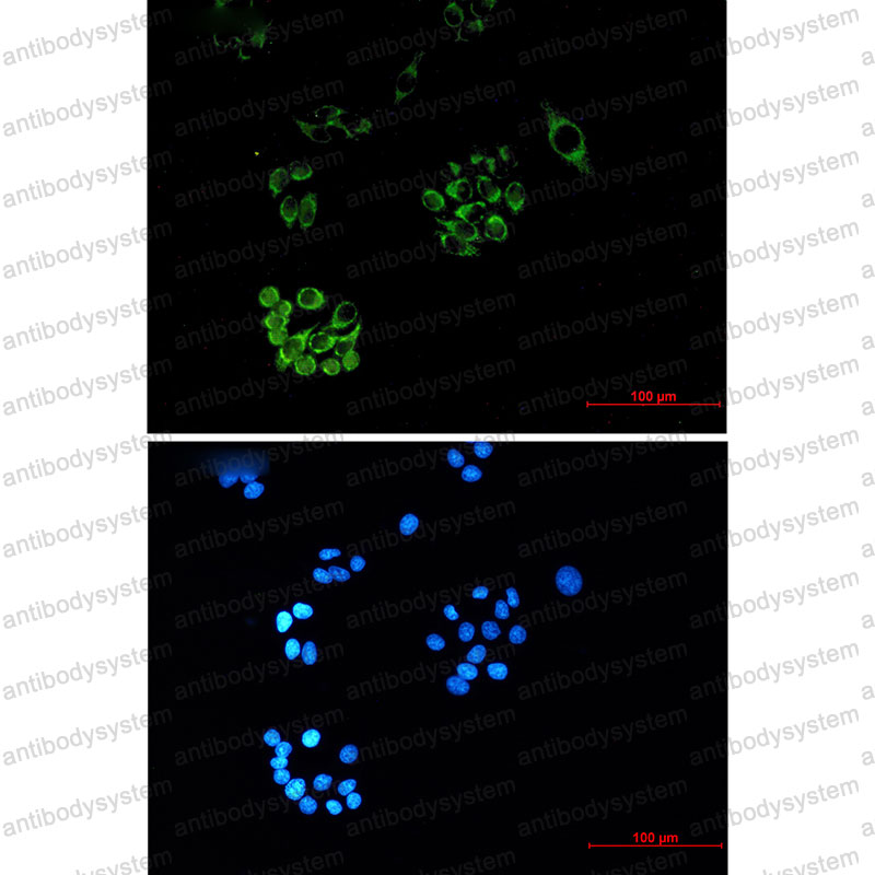 Anti-FH Antibody (R3A43)