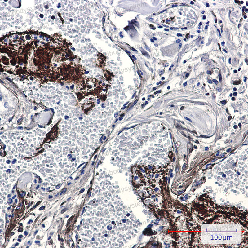 Anti-THBS1 Antibody (R1L31)
