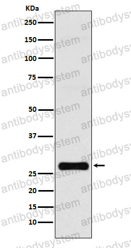 Anti-GJB1 Antibody (R1L32)