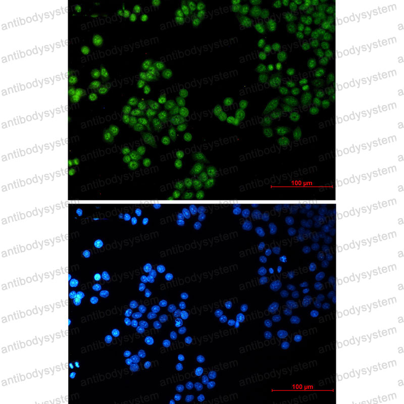 Anti-SP1 Antibody (R1L34)