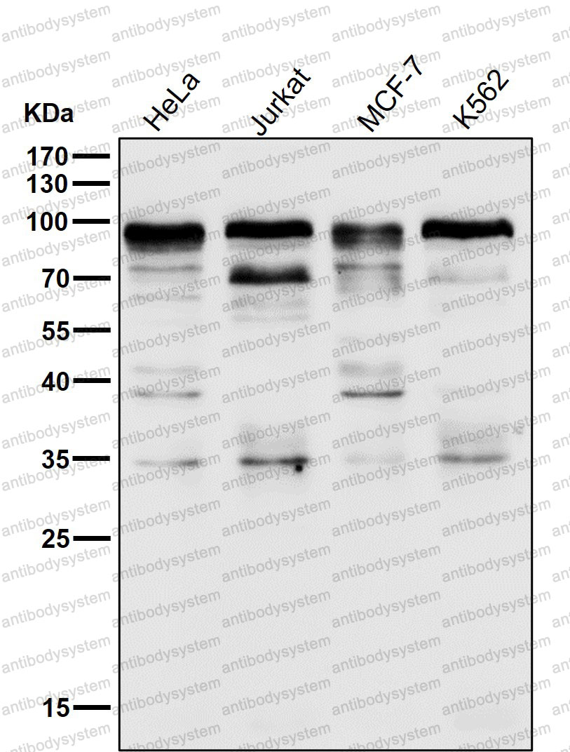 Anti-SP1 Antibody (R1L33)
