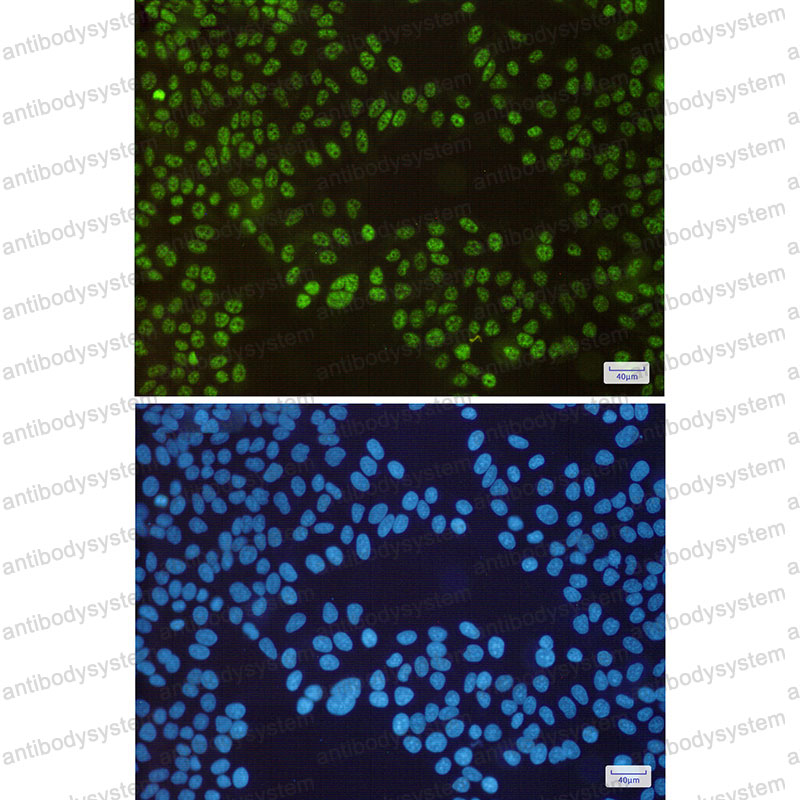 Anti-SP1 Antibody (R1L35)