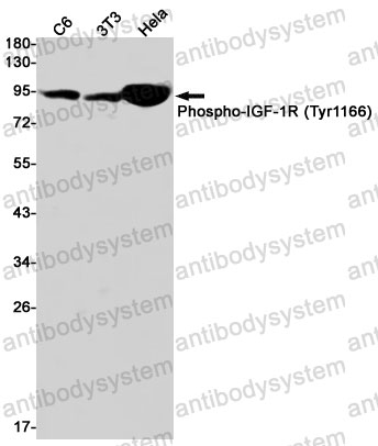 Anti-Phospho-CD221/IGF1R (Tyr1166) Antibody (R1L36)