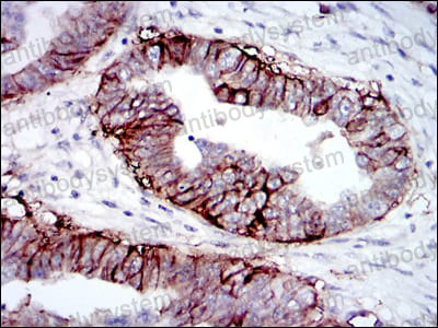 Anti-CD221/IGF1R Antibody (R3A52)
