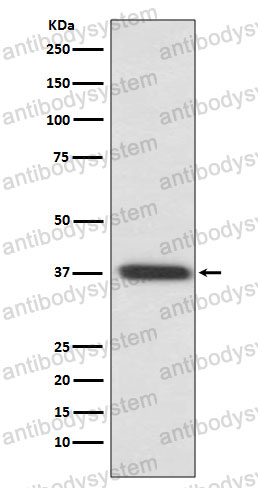 Anti-RHO/Rhodopsin Antibody (R1L39)