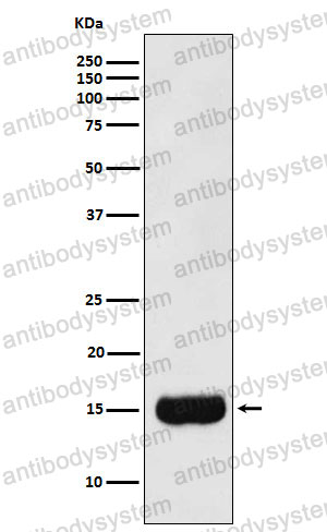 Anti-MSMB Antibody (R1L40)