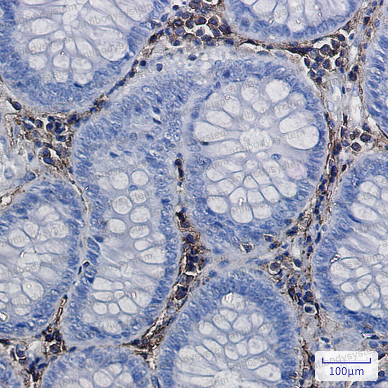 Anti-ANXA6 Antibody (R1L43)