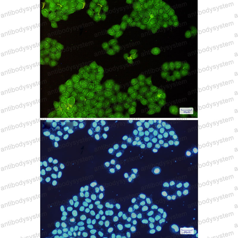 Anti-ANXA6 Antibody (R1L41)