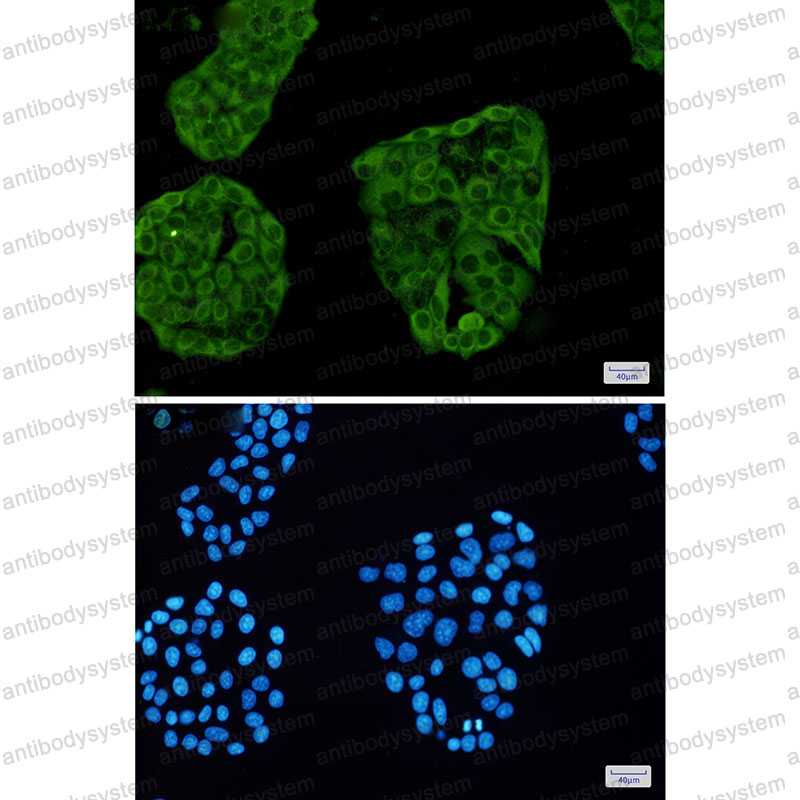 Anti-ANXA6 Antibody (R1L42)