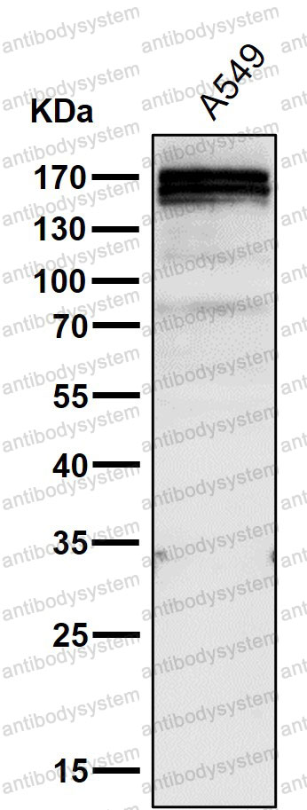 Anti-GLI1 Antibody (R1L44)