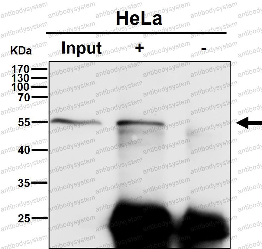 Anti-CHRM2 Antibody (R1L45)