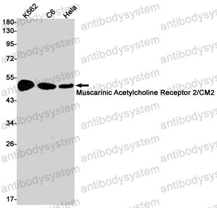 Anti-CHRM2 Antibody (R1L46)