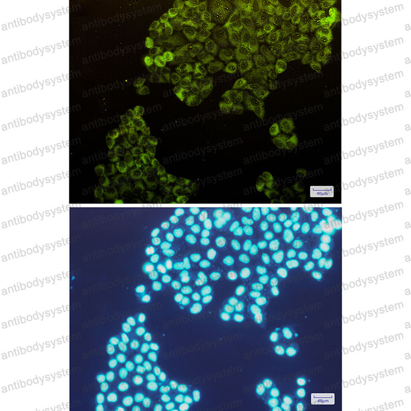 Anti-PFKM Antibody (R1L52)