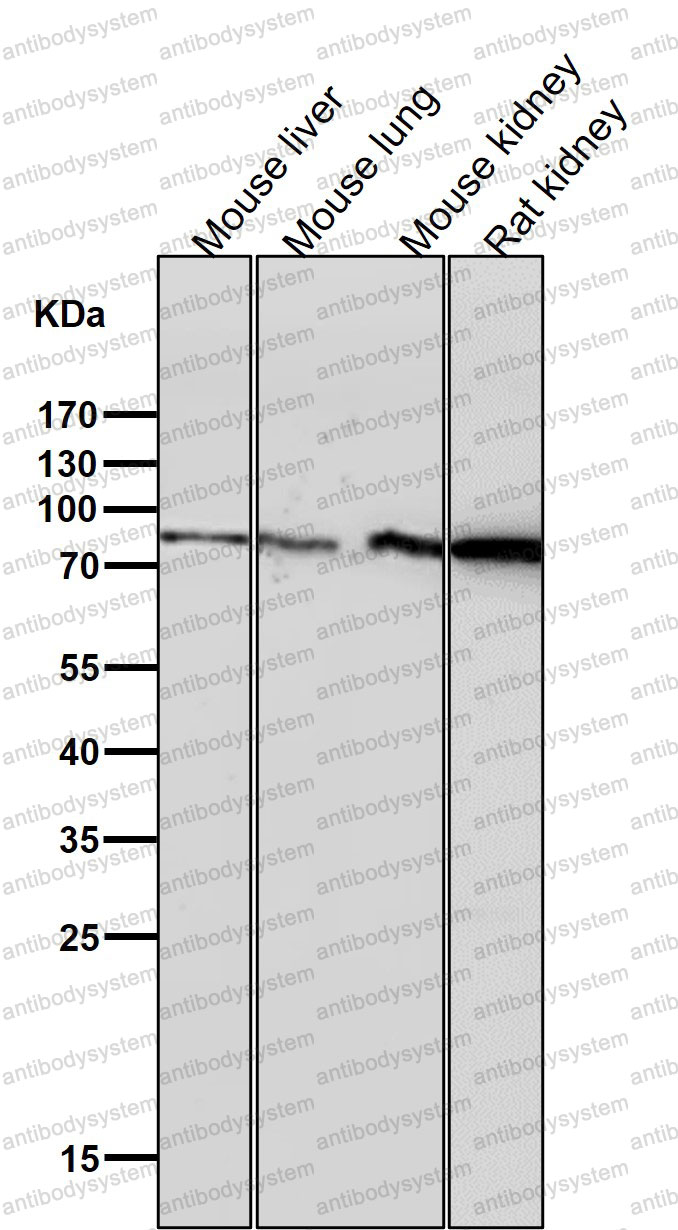 Anti-PFKM Antibody (R1L51)