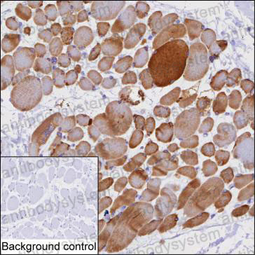 Anti-PFKM Antibody (R3A61)
