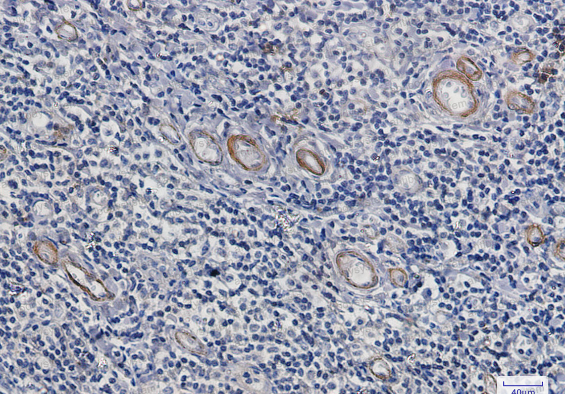 Anti-ASNS Antibody (R1L55)