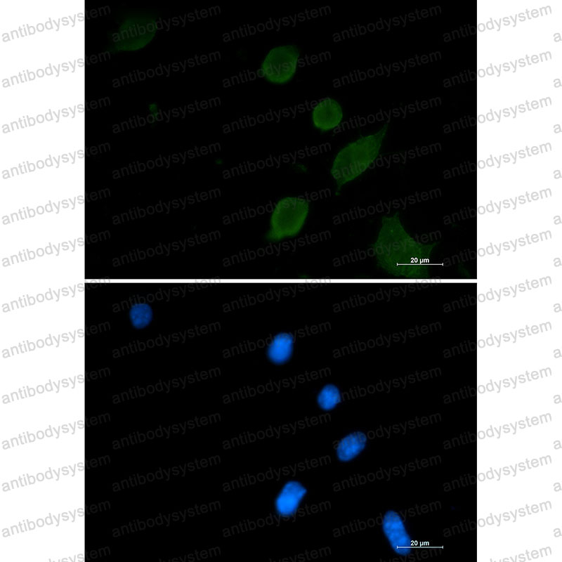 Anti-SYP/Synaptophysin Antibody (R1L56)