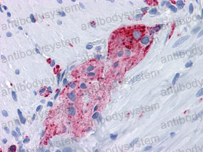 Anti-SYP/Synaptophysin Antibody (R3A67)