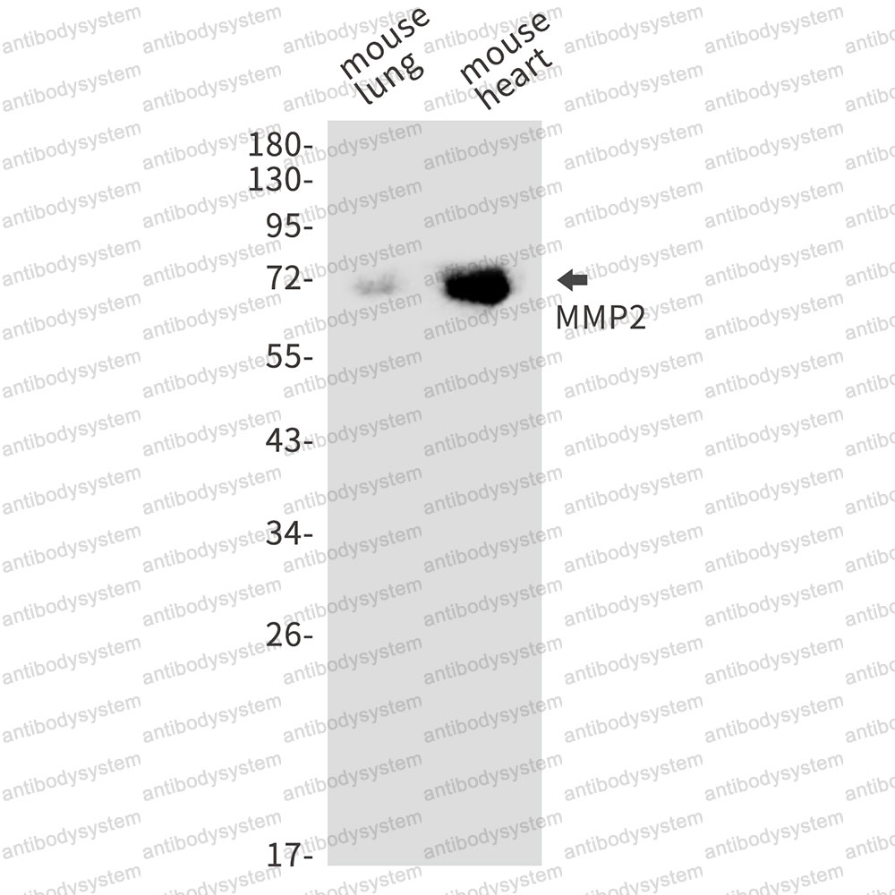 Anti-MMP2 Antibody (R1L57)