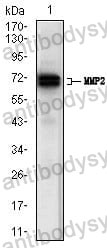 Anti-MMP2 Antibody (R3A69)