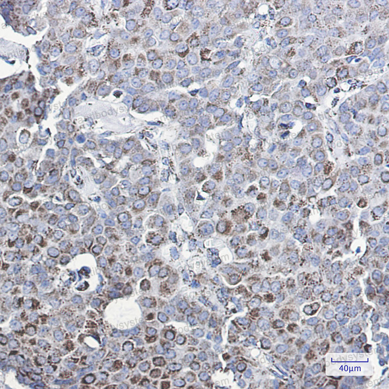 Anti-MMP3 Antibody (R1L58)