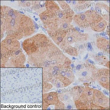Anti-GSTA1 Antibody (R3A72)