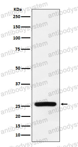 Anti-SOD3 Antibody (R1L59)