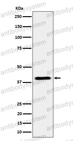 Anti-ADH4 Antibody (R1L60)