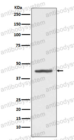 Anti-HMBS Antibody (R1L61)