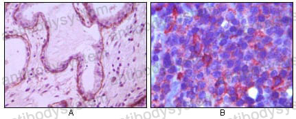 Anti-CD10/MME Antibody (R3A73)