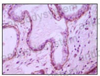 Anti-CD10/MME Antibody (R3A74)
