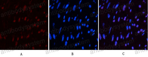 Anti-CD10/MME Antibody (R3A84)