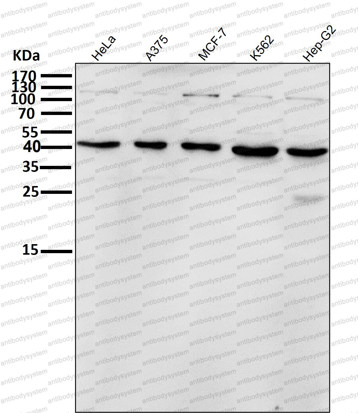 Anti-INHBA Antibody (R1L62)