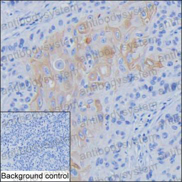 Anti-INHBA Antibody (R3A85)