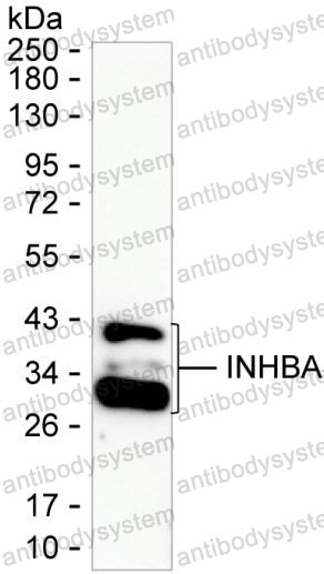 Anti-INHBA Antibody (R3A86)
