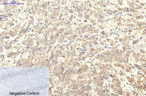 Anti-CD41/ITGA2B Antibody (R3A88)