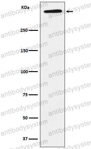 Anti-LPA Antibody (R1L65)