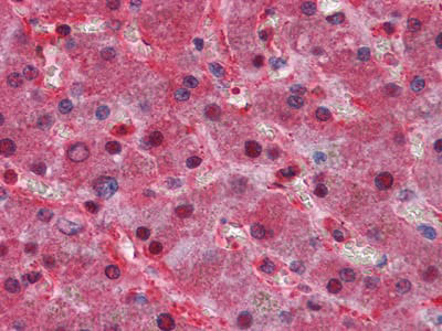 Anti-LPA Antibody (R3A89)