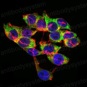 Anti-LPA Antibody (R3A90)