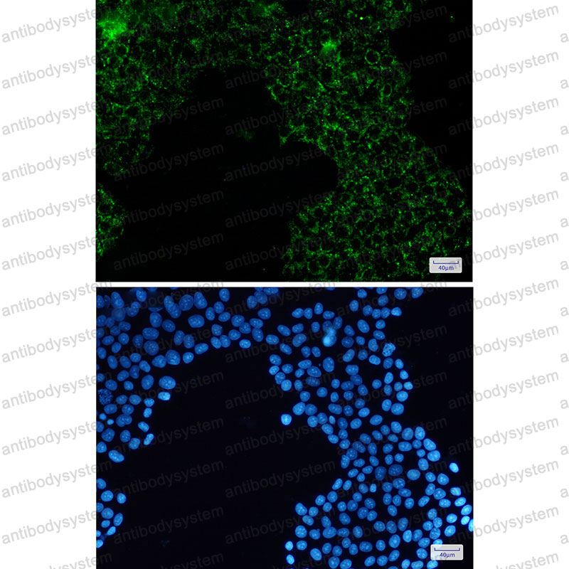 Anti-PDHA1 Antibody (R1L66)