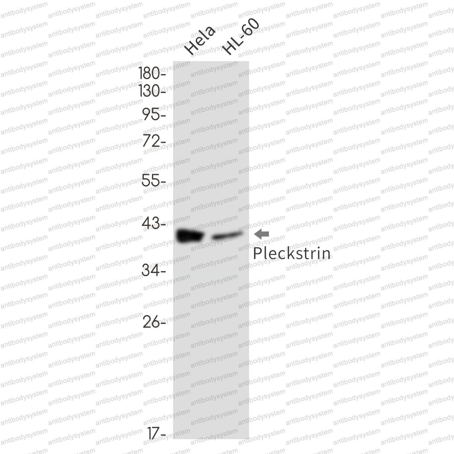 Anti-PLEK Antibody (R1L68)
