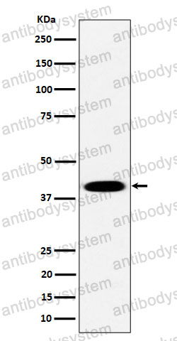 Anti-PLEK Antibody (R1L67)