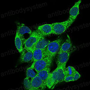 Anti-CD14 Antibody (R3A96)