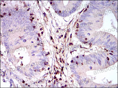 Anti-CD45/PTPRC Antibody (R3B01)